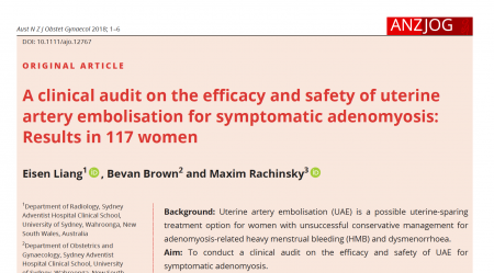 Screenshot of Dr Liang's article on the efficacy and safety of Uterine Artery Embolization.