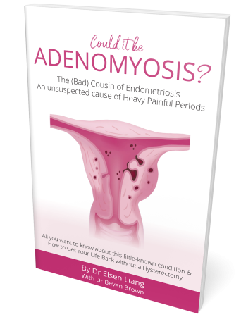 Our Book "Could it be Adenomyosis? The Bad Cousin of Endometriosis" 1st Ed 2021.